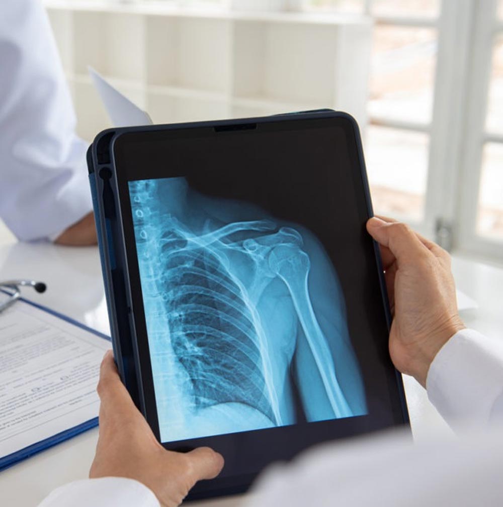 Benefits of shoulder replacement surgery