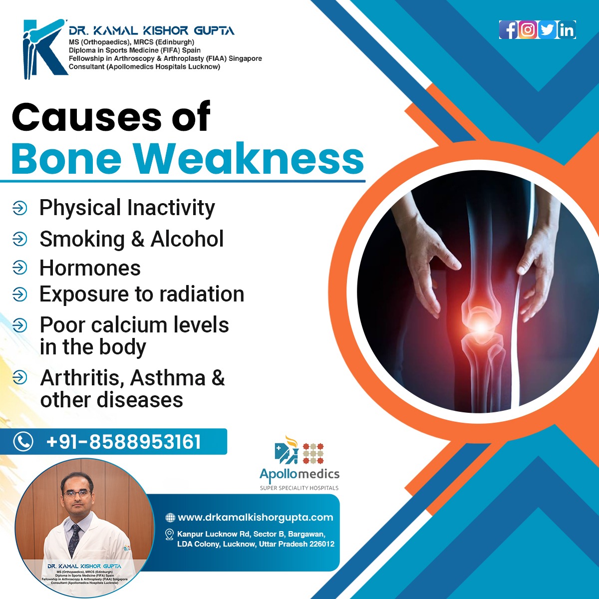 Orthopedic Doctor In Lucknow